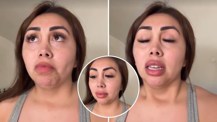 “A la gente infeliz...” Naya Fácil arremetió contra quienes critican su afección en la piel