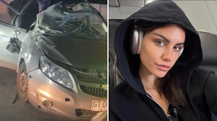 “Así está hoy”: Emilia Dides mostró heridas de grave accidente automovilístico que sufrió hace 2 años