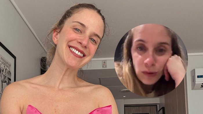 FOTO | “Salió sangre, así que 5 vacunas”: Alison Mandel muestra su herida tras ser atacada por un perro en la calle