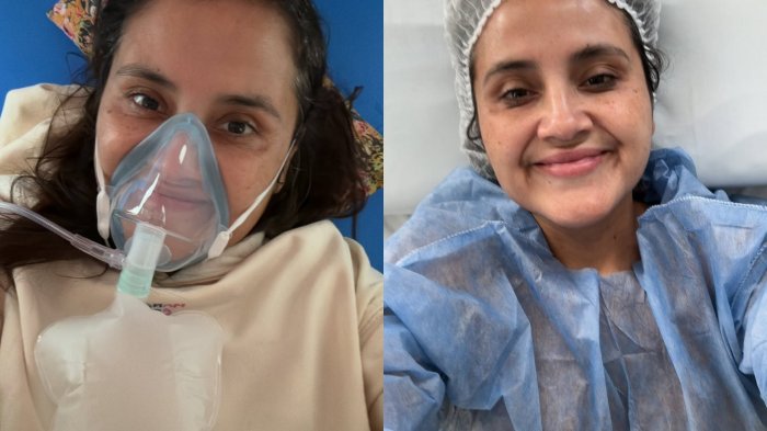 Pamela Leiva contó toda la verdad sobre su cirugía estética secreta: “Semanas dolorosas”