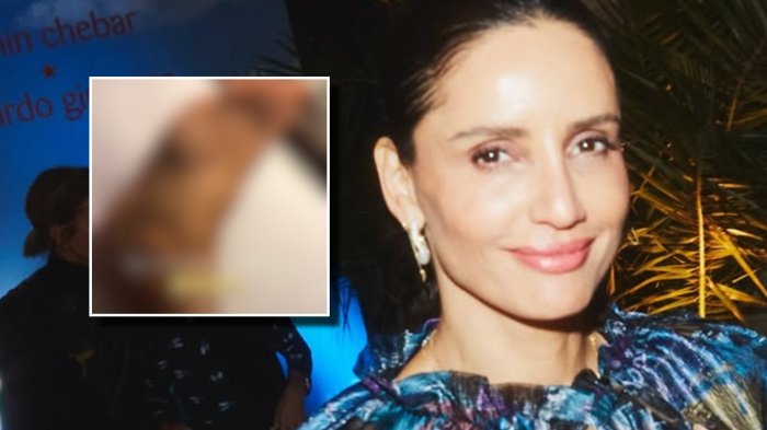 “Triple fractura”: Leonor Varela sufre complejo accidente doméstico en México y revela su estado de salud