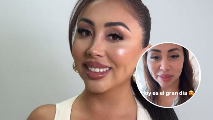 FOTO | “Un sueño”: Naya Fácil se sometió a procedimiento estético e impactó con el resultado