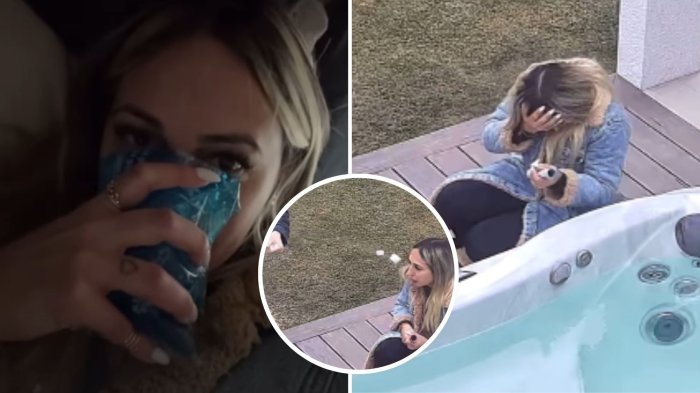 “Me fracturó la nariz”: Rebe Naranjo causó preocupación tras episodio con Nano Calderón