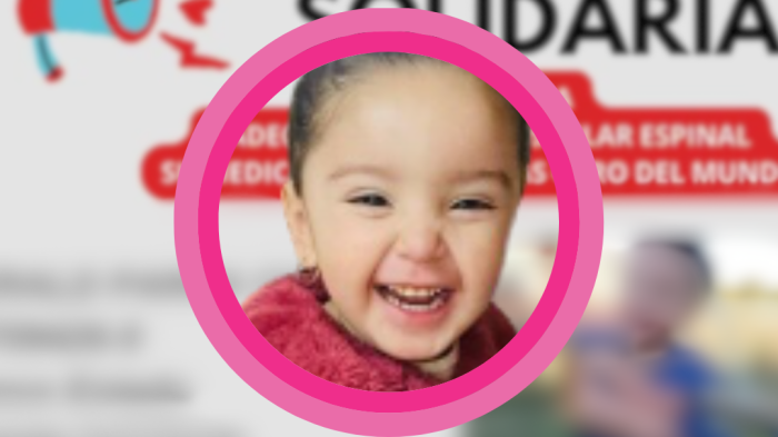 Familia de Curacautin necesita ayuda económica para costoso tratamiento de su pequeña hija que sufre extraña enfermedad