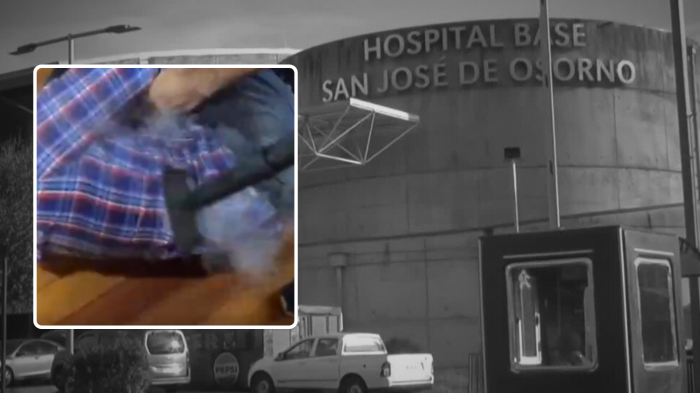 VIDEO | Lo quemaron con plancha a vapor: Los registros de torturas a trabajador TEA en Hospital de Osorno