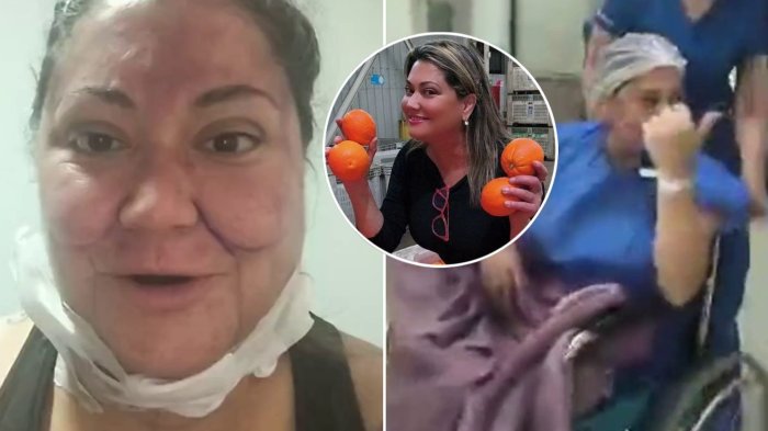 Denisse Campos volvió al trabajo tras 6 cirugías y preocupó a seguidores: Así luce ahora