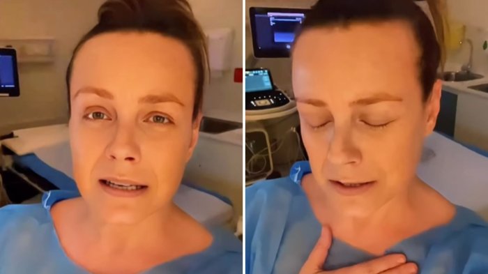 “Quiero confesarles...”: Claudia Conserva compartió potente reflexión tras mamografía