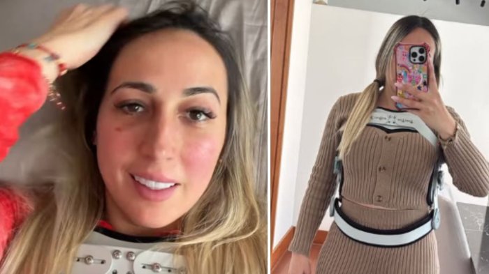 “Le dije ‘me voy a morir’”: El crudo relato de la pareja de Nano Calderón tras accidente en moto