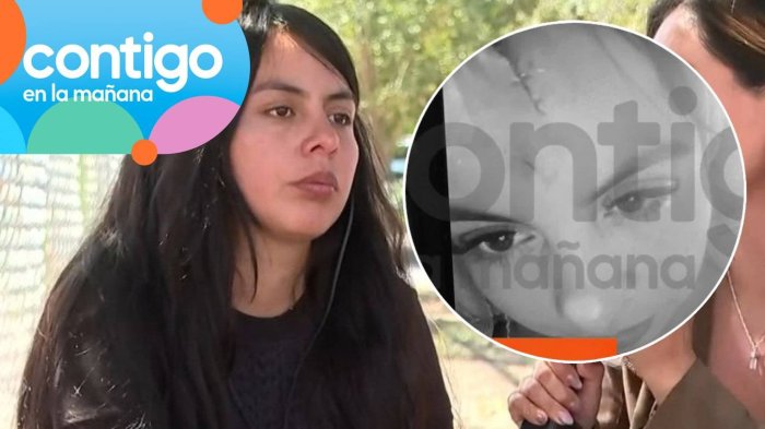 Hermana de Krishna Aguilera fue atacada brutalmente cerca de su antigua casa en San Bernardo