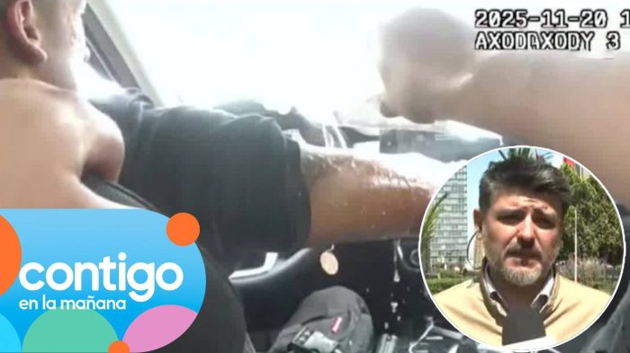 “Tiene que hacerse injerto”: Guardia municipal tuvo grave secuela tras ataque con aceite hirviendo en Meiggs