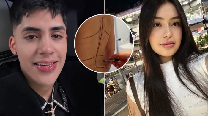 Revelan antes y después de intervención estética de expolola de Cris MJ: “Feliz con los resultados”