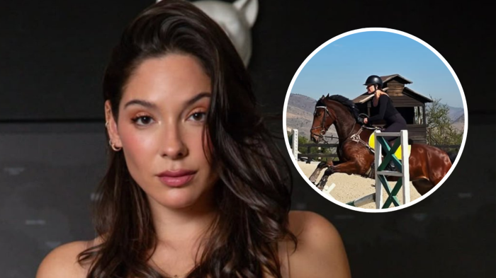 Kel Calderón mostró las consecuencias que le dejó fuerte accidente a caballo