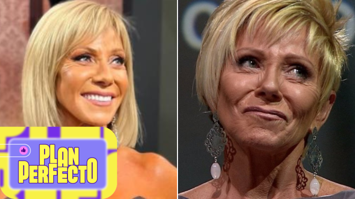 ¡Siempre jóvenes! Así es el impactante antes y después de famosos chilenos tras cirugías