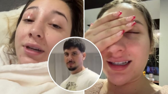 ANTES Y DESPUÉS | “Ya me tuneé”: Pareja de Matt Hunter se realizó compleja intervención estética