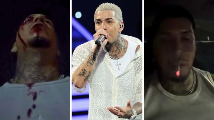 El video de Young Cister que causa preocupación en redes: Aparece ensangrentado y fans lanzan teoría