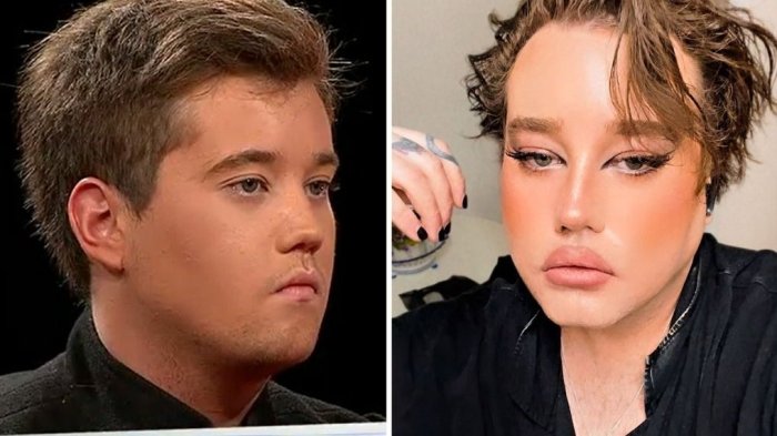 ¿Lo recuerdas? Nico Yunge reapareció en redes y sorprendió con nueva imagen tras perder 40 kilos