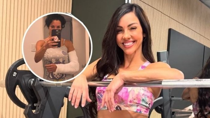 FOTOS | Paloma Fiuza muestra cómo quedó su brazo tras sufrir brutal caída: “Sentí un dolor extremo”