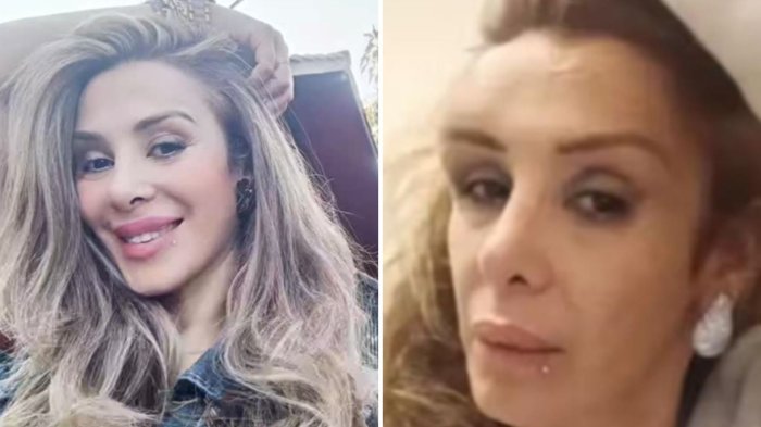 “Me dijo que me iba a matar”: Exchica Mekano fue víctima de brutal agresión al interior de discoteque capitalina