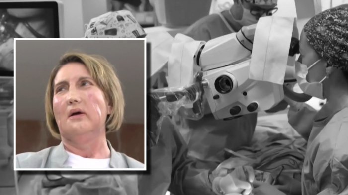 Video | Así fue el primer trasplante de cara de una paciente eutanasiada en el mundo