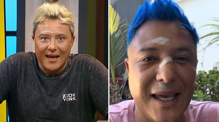 “Salió mucha sangre…”: Sergio Rojas reveló fuerte accidente que lo tuvo fuera de pantalla