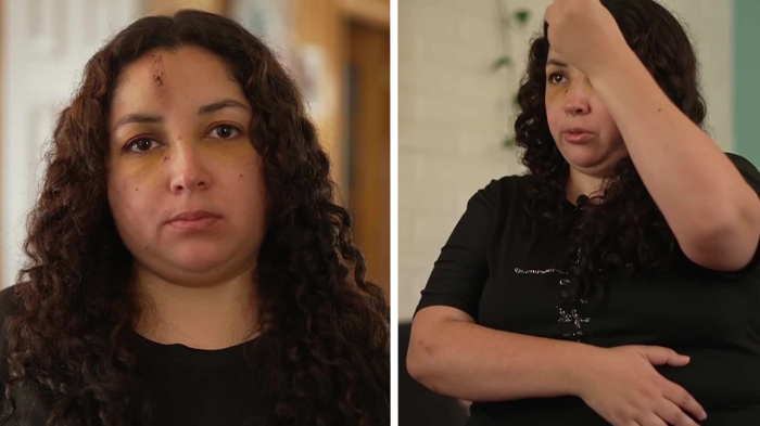 EXCLUSIVO | Habla trabajadora agredida en residencia de menores: “Ella estaba con un cuchillo”