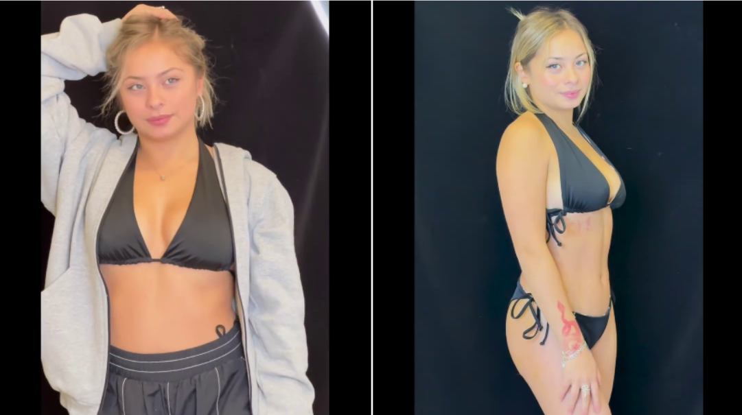 Skarleth Labra mostró el antes y después de su liposucción. Fuente: Instagram.
